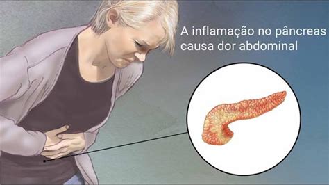 pancreatite aguda sintomas